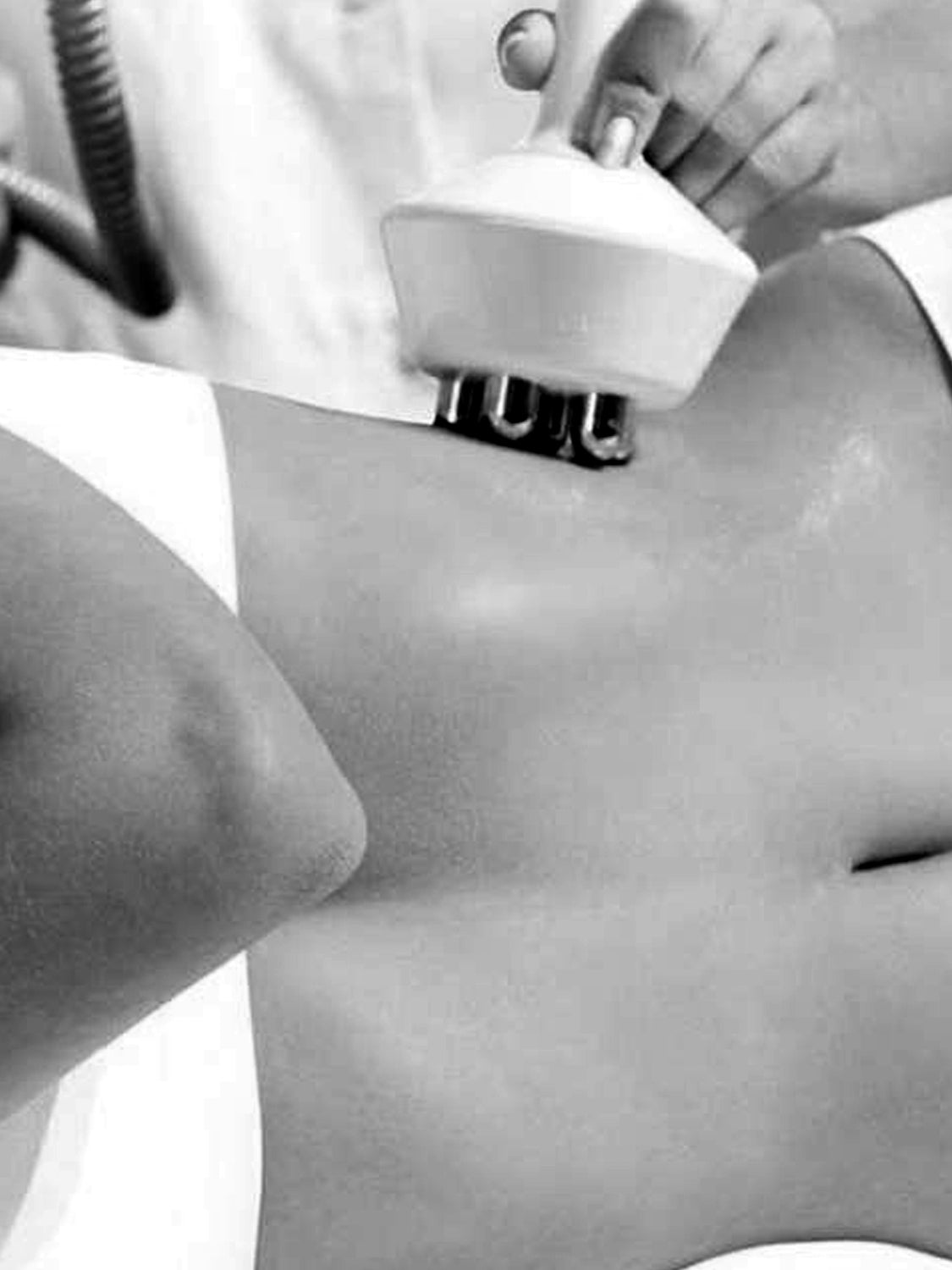 Radiofrequency Reaction by Viora